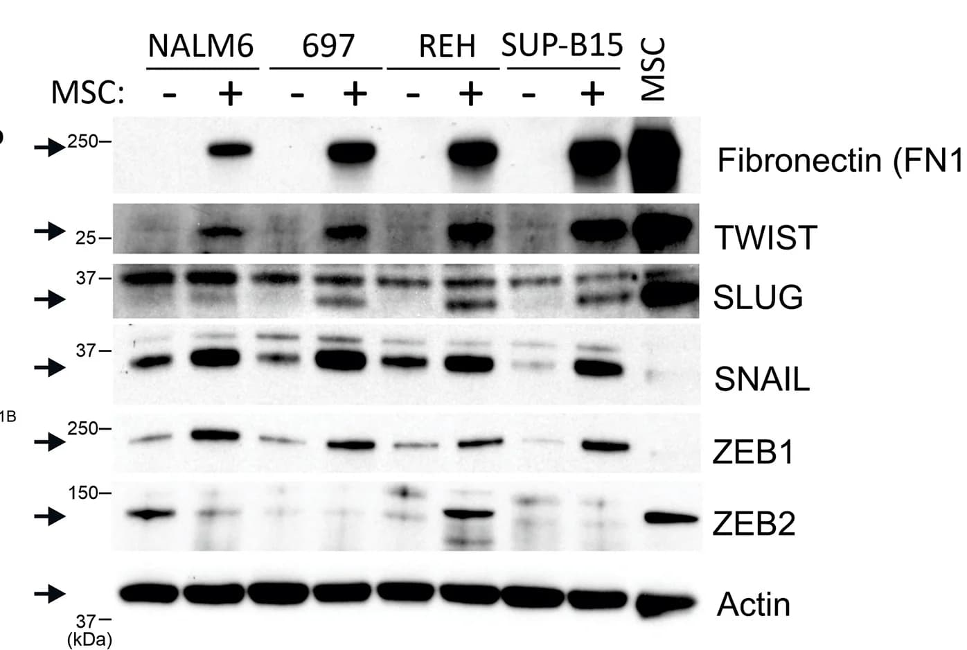 Open access visualization of Gel, Immunoblotting, EMT Markers, Adh Cells