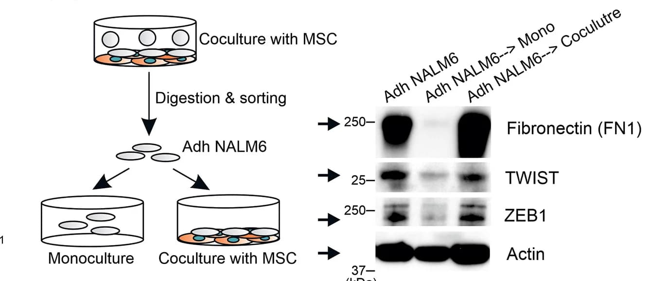 Open access visualization of Workflow, Gel, EMT State, YFP+NALM6 Cells, MSCs