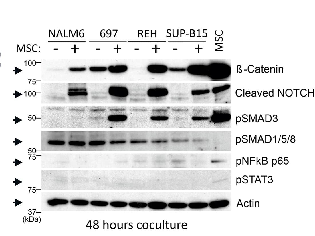 Open access visualization of Gel, Immunoblotting, Fibronectin, TWIST, SLUG