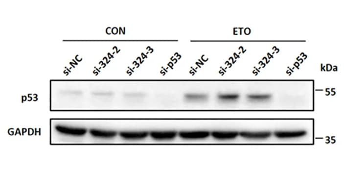 Open access visualization of Gel, p53, Western Blotting