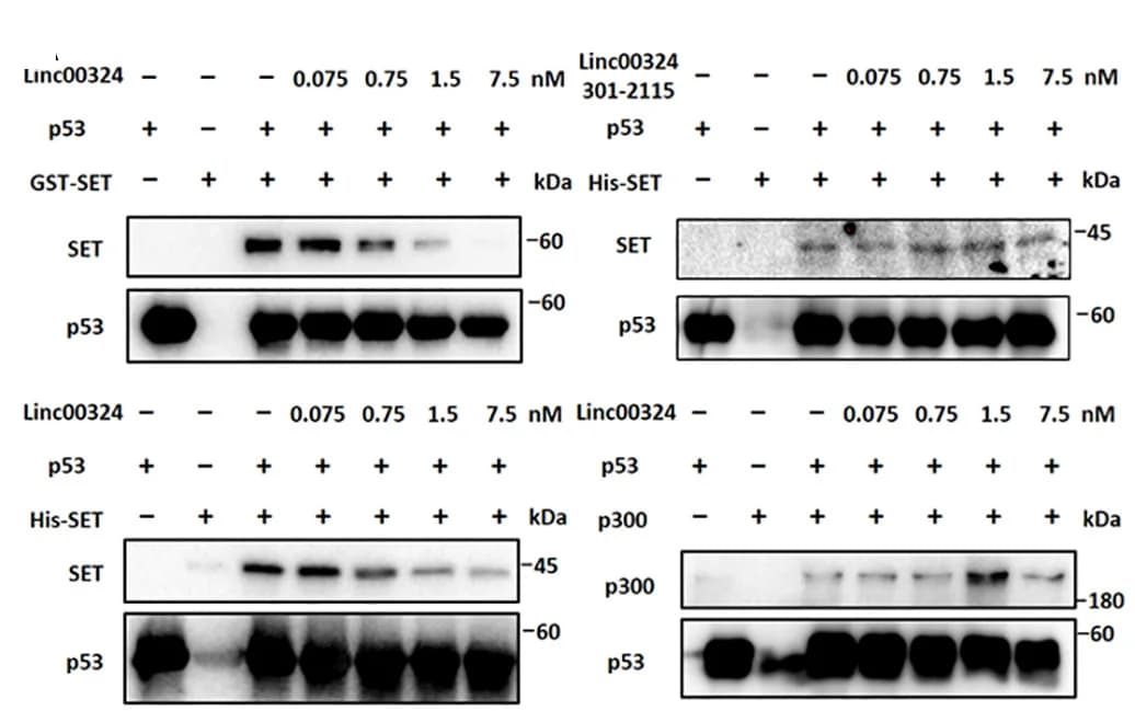 Open access visualization of Gel, Coimmunoprecipitation, LINC00324, p53, SET