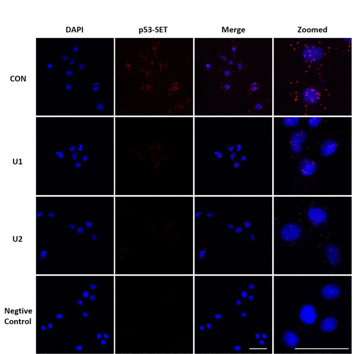 Open access visualization of Microscopy, Duolink PLA, p53, SET, U2OS Cells