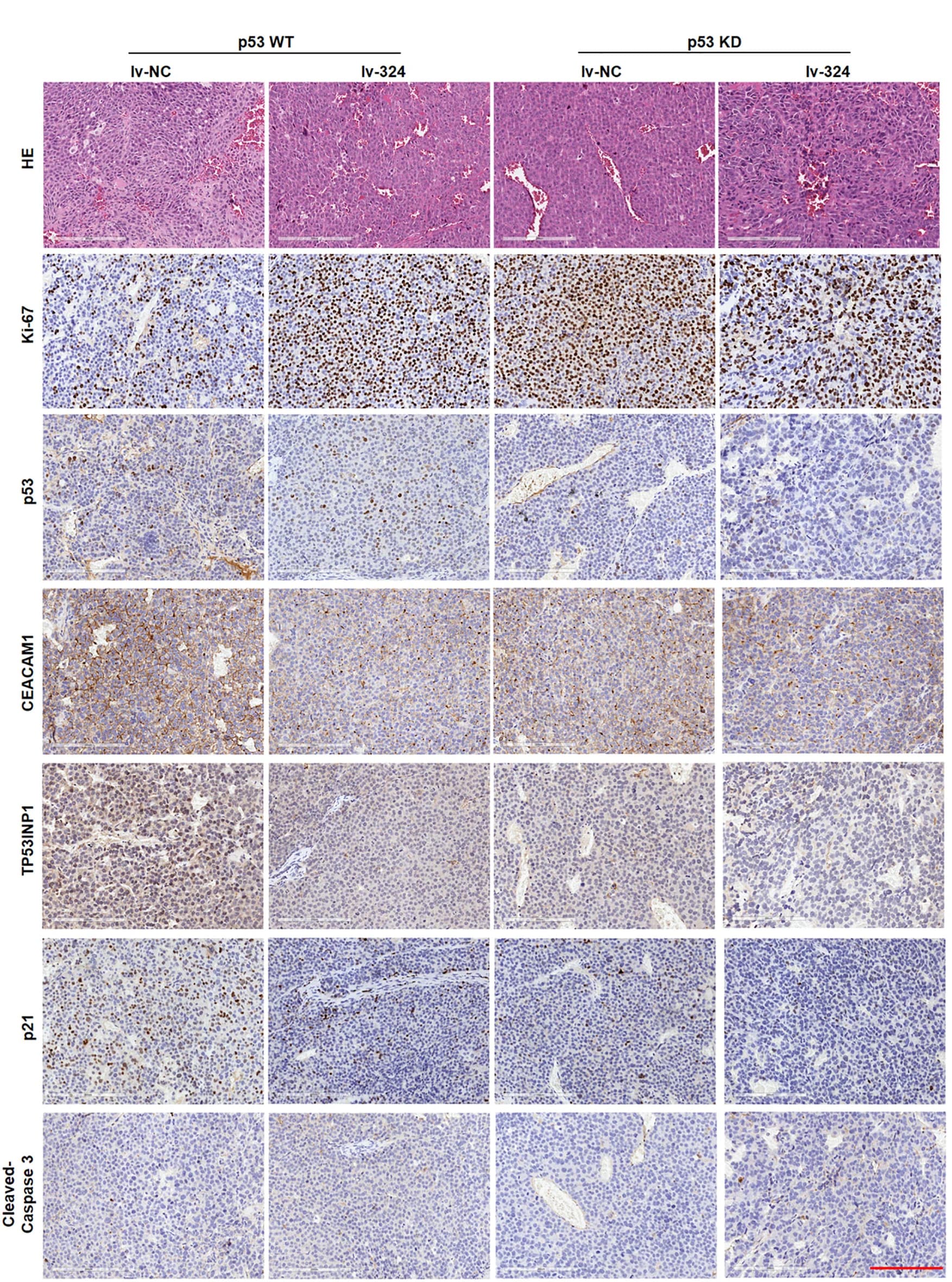 Open access visualization of Microscopy, H&E Staining, IHC Staining, Xenograft Tumors