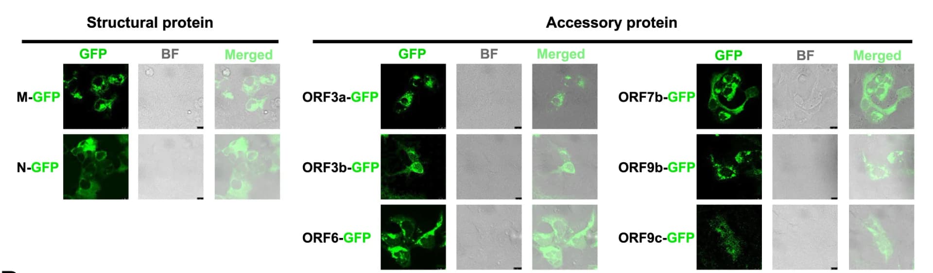 Open access visualization of Microscopy, Confocal Microscopy, vPOI-GFP Constructs, HEK293-AD Cells, Bright Field