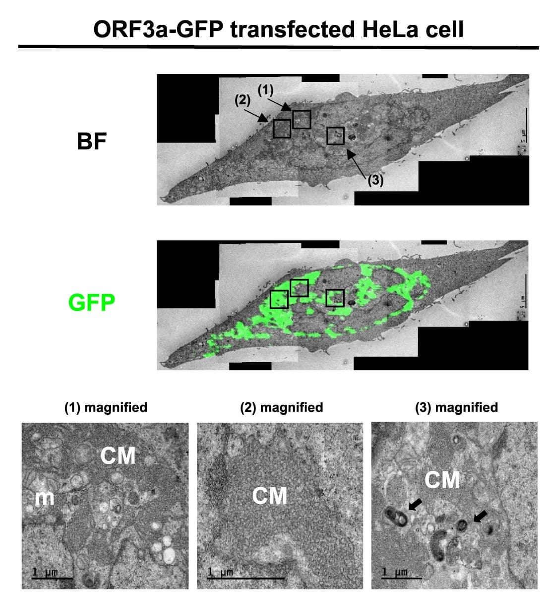 Open access visualization of Microscopy, CLEM, HeLa Cells, Autophagic Vesicles
