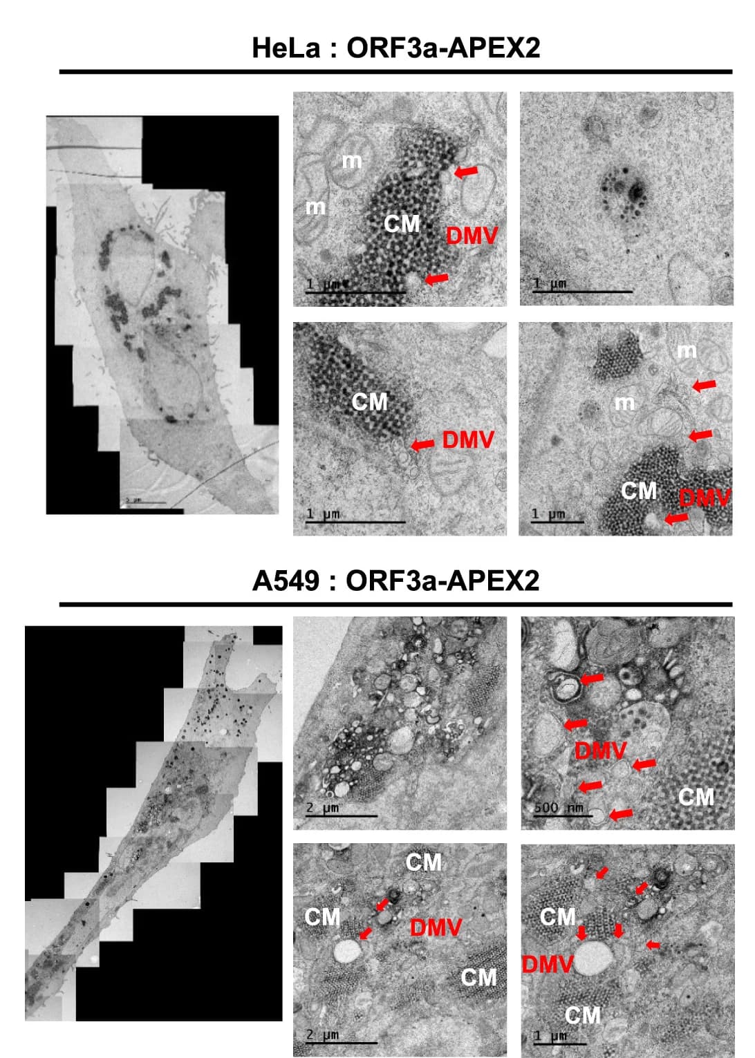 Open access visualization of Microscopy, EM, HeLa Cells, A549 Cells, ORF3a-APEX2