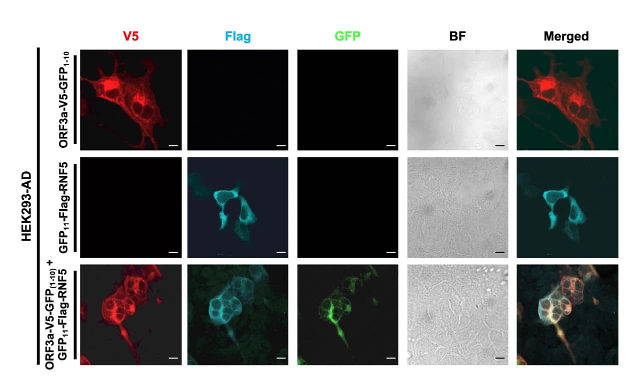 Open access visualization of Microscopy, Confocal Microscopy, ORF3a-V5-GFP1-10, GFP11-FLAG-RNF5, HEK293-AD Cells