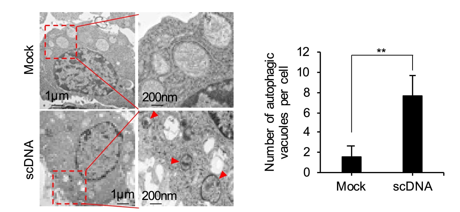 Open access visualization of Microscopy, Bar Plot, Error Bars, Electron Micrographs, Autophagic Vacuoles