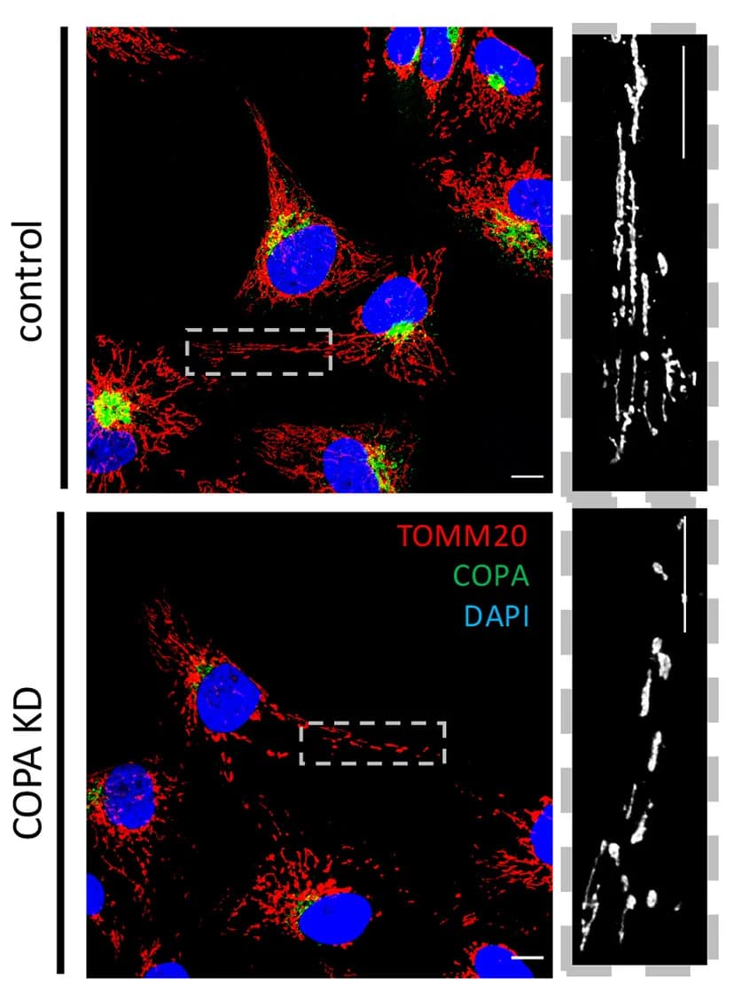 Open access visualization of Microscopy, SH-SY5Y Cells, Mitochondria, COPA, Immunofluorescence