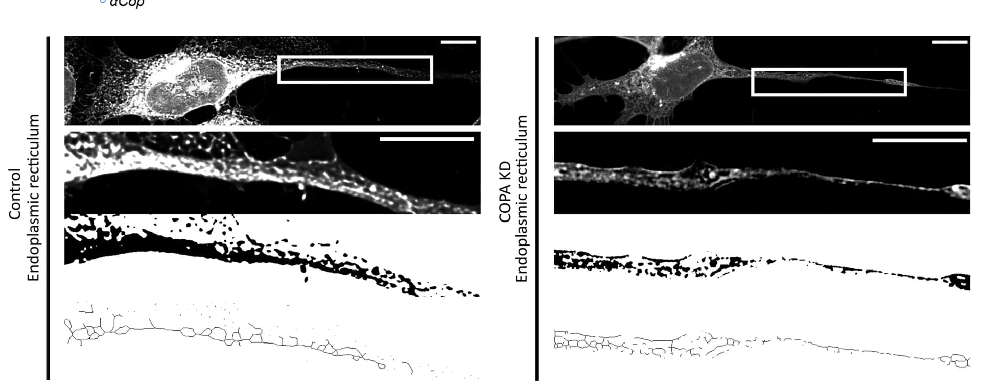 Open access visualization of Microscopy, ER morphology, Neurites, SH-SY5Y cells, Glycoprotein