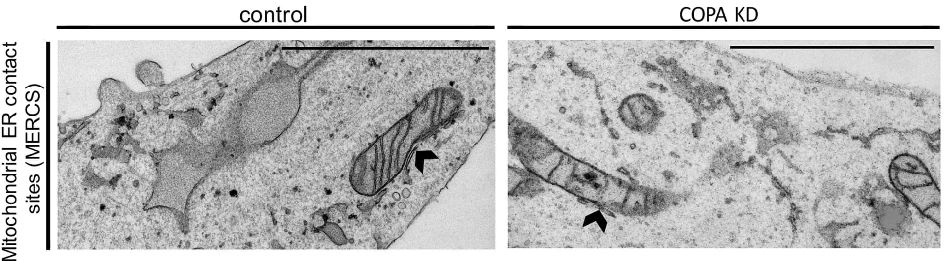 Open access visualization of Microscopy, TEM, Mitochondria-ER Contact Sites, Neurites, COPA KD SY-SY5Y Cells