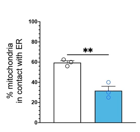 Open access visualization of Bar Plot, Error Bars, Mitochondria, Endoplasmic Reticulum, Neurites