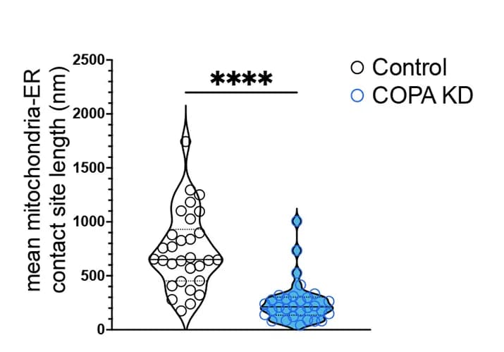 Open access visualization of Violin Plot, Scatter Plot, Mitochondria-ER Contact Sites, Neurites, COPA-KD SH-SY5Y Cells