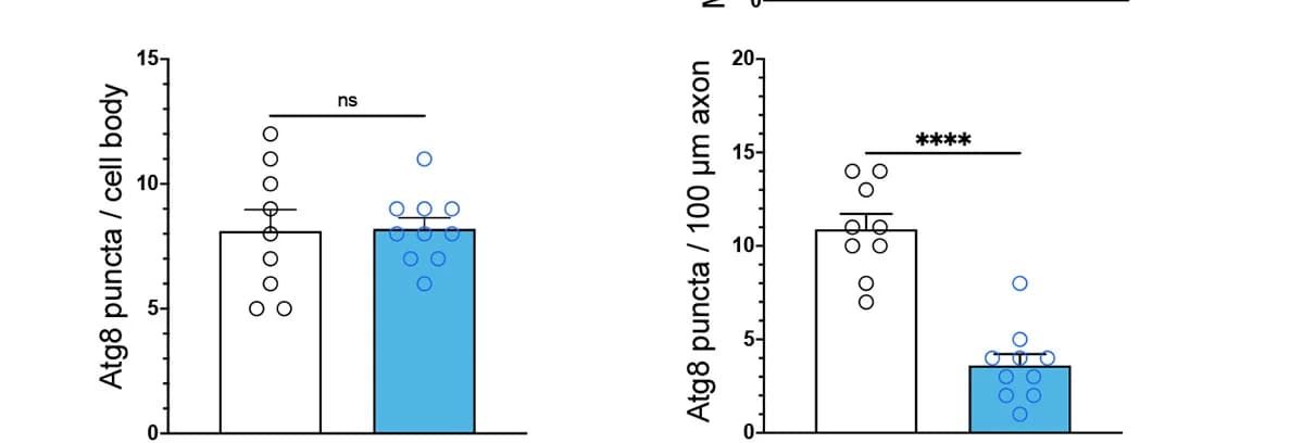 Open access visualization of Bar Plot, Scatter Plot, Error Bars, Autophagosomes, Axon Mitochondria