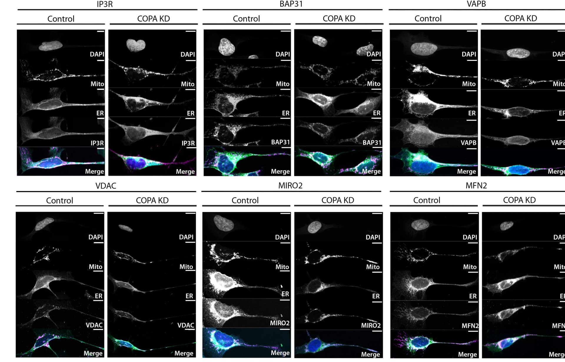 Open access visualization of Microscopy, SH-SY5Y Cells, DAPI, Nuclei, TOMM20