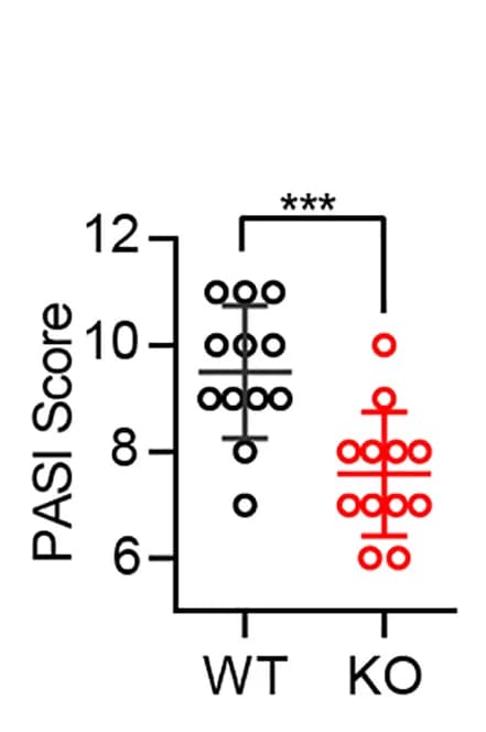 Open access visualization of Scatter Plot, Error Bars, WT Mice, Slc38a5 Mice, IMQ Cream