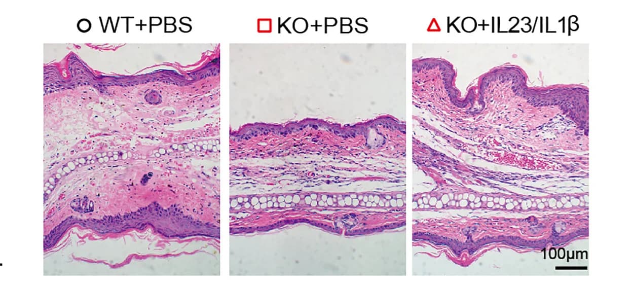Open access visualization of Microscopy, Mice, PBS, IL-23, IL-1β