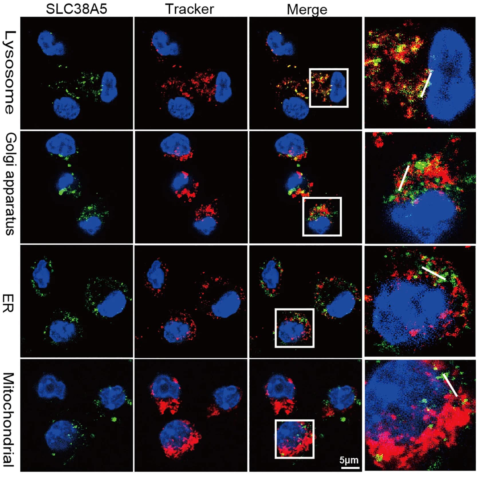 Open access visualization of Microscopy, Confocal Microscopy, SLC38A5, BMDCs, Organelles Tracker