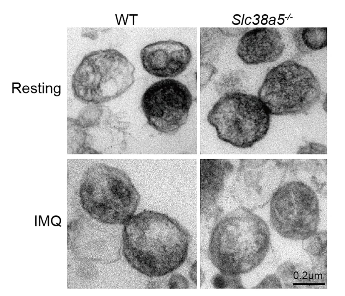 Open access visualization of Microscopy, Lysosomal-Rich Fractions, IMQ-treated, BMDCs, Transmission Electron Microscopy