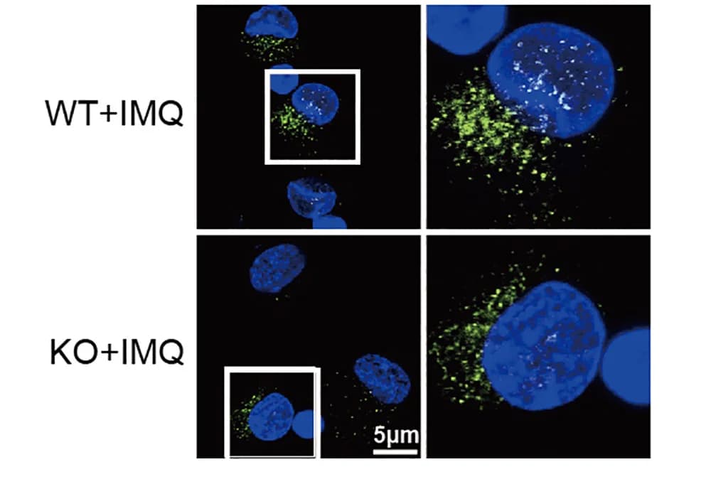 Open access visualization of Microscopy, Wild-Type, Slc38a5−/− BMDCs, IMQ, Lysosomal pH