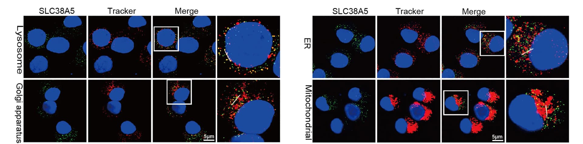 Open access visualization of Microscopy, Confocal Microscopy, Subcellular Localization, SLC38A5, Monocyte-Derived DCs