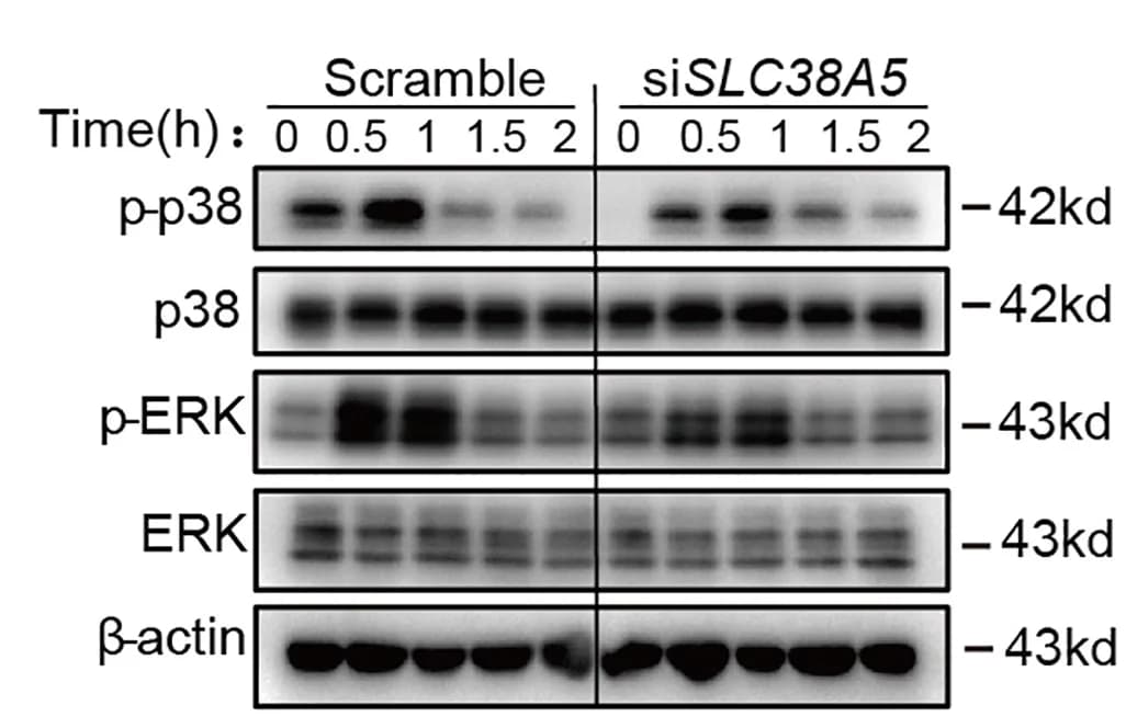 Open access visualization of Gel, SLC38A5-silenced, Monocyte-Derived DCs, Control Cells, IMQ