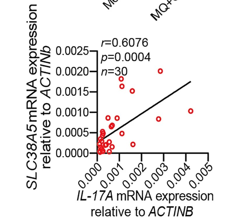 Open access visualization of Scatter Plot, Regression Plot, PASI Score, IL-23, IL-1β