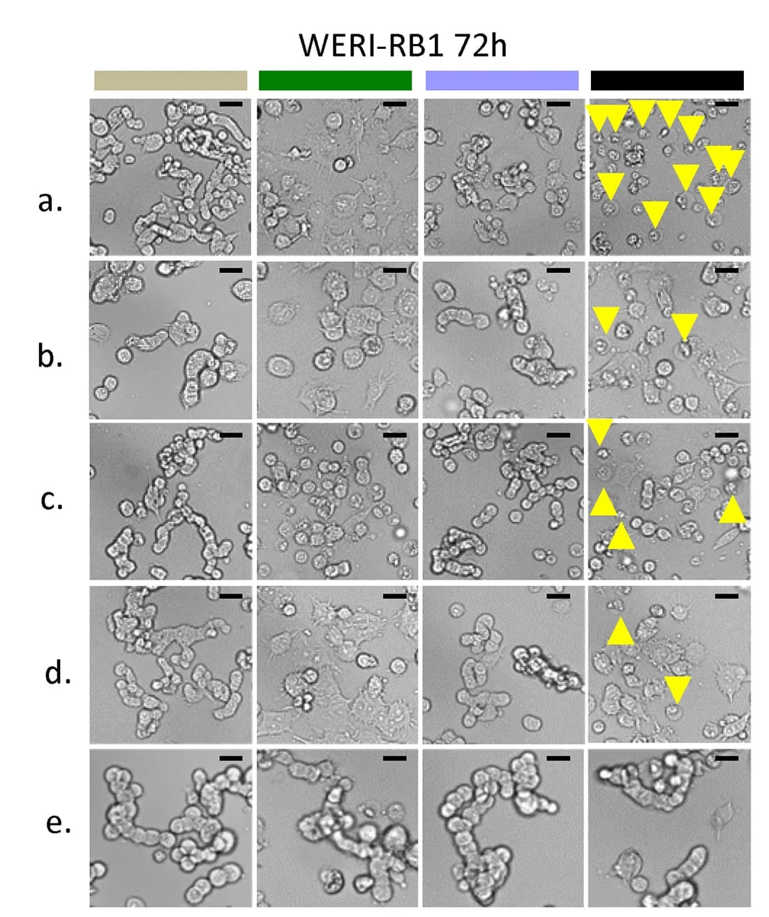 Open access visualization of Microscopy, Cell Morphology, Apoptotic Cells, MLN, TPT