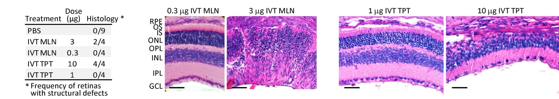 Open access visualization of Microscopy, Table Image, IVT MLN, TPT, Retinal Morphology