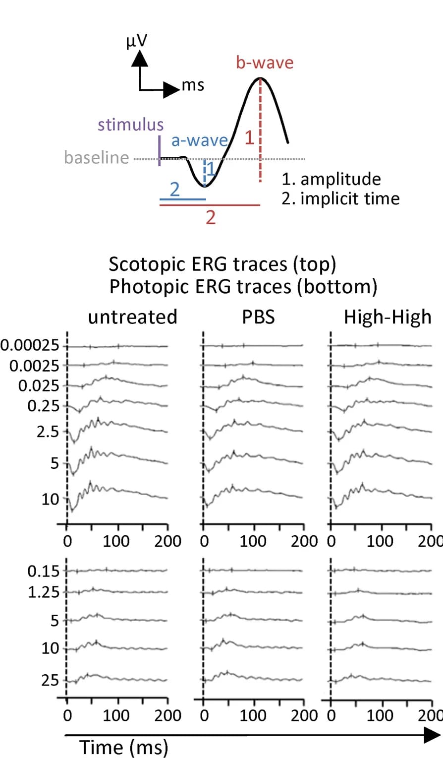 Open access visualization of Line Plot, Electroretinogram, ERG, Combination Therapy