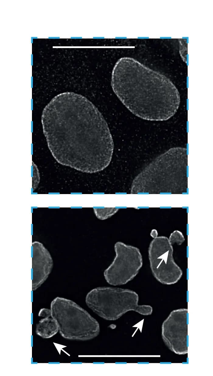 Open access visualization of Microscopy, HeLa Cells, Nuclear Blebbing
