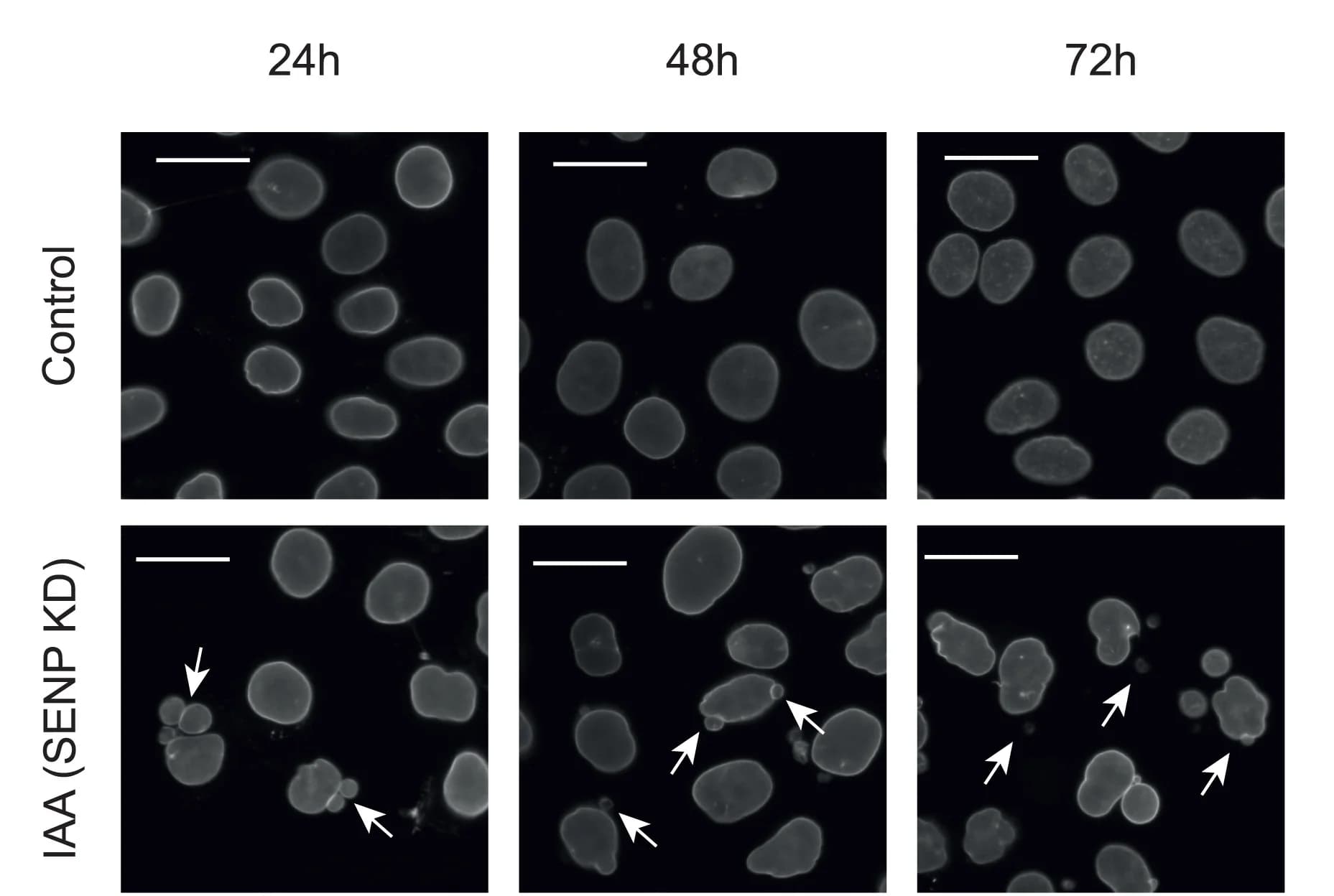 Open access visualization of Microscopy, Immunofluorescence, HeLa Cells, GFP-AID-SENP6, Ethanol
