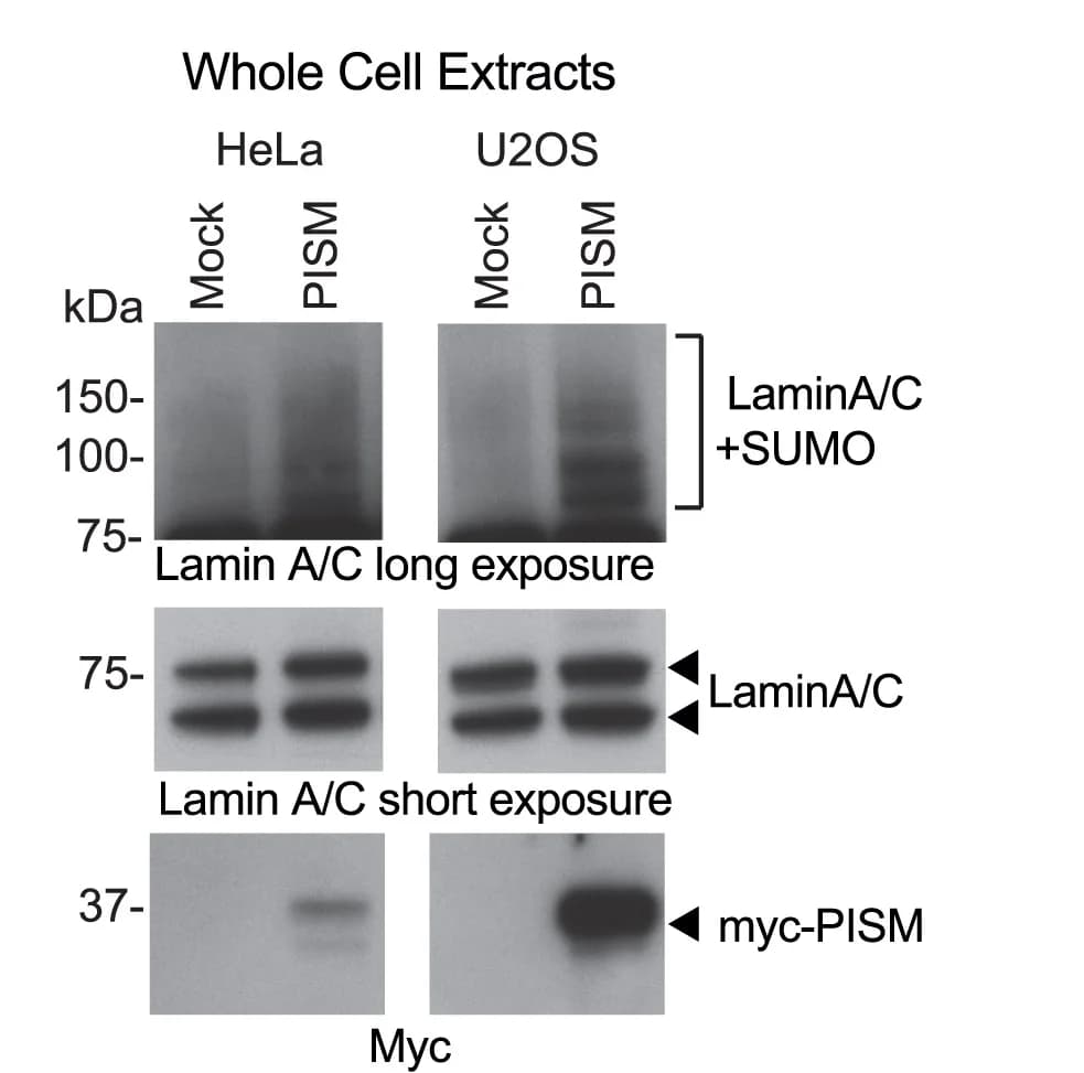 Open access visualization of Gel, Western Blot, HeLa Cells, U2OS Cells, Myc-tagged Lamin A