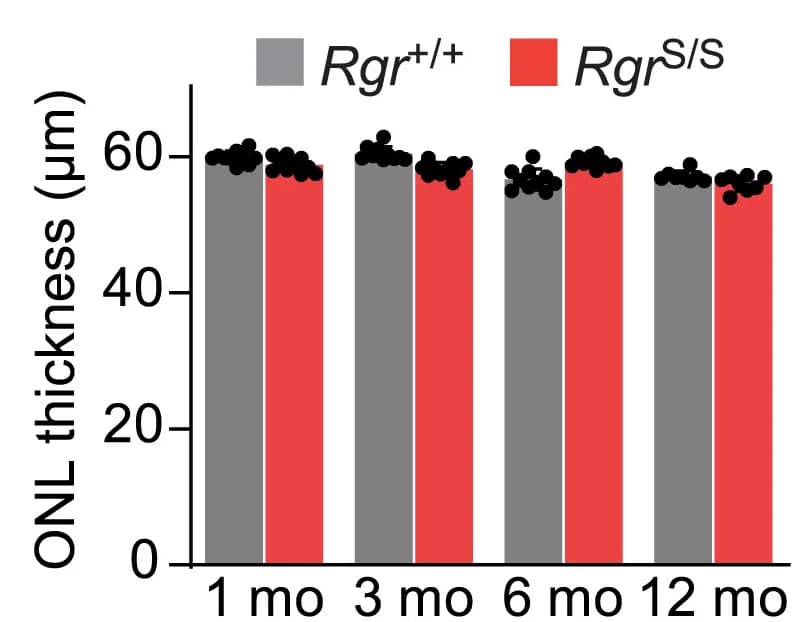 Open access visualization of Bar Plot, Clustered, OCT Quantification, ONL Thickness, Rgr+/+ Mice