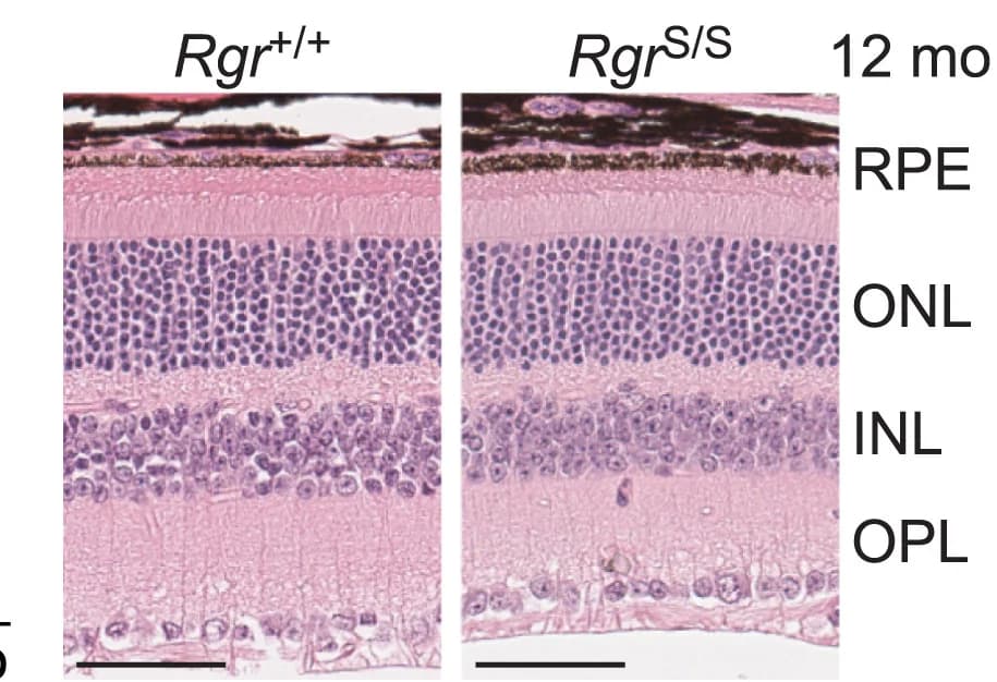 Open access visualization of Microscopy, H&E Staining, Retinal Sections, Rgr+/+ Animals, RgrS/S Animals