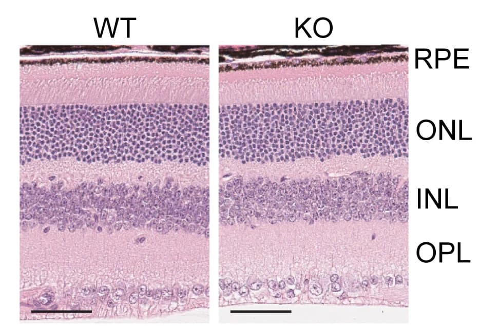 Open access visualization of Microscopy, H&E Staining, Retinal Sections, Wild Type, Knockout