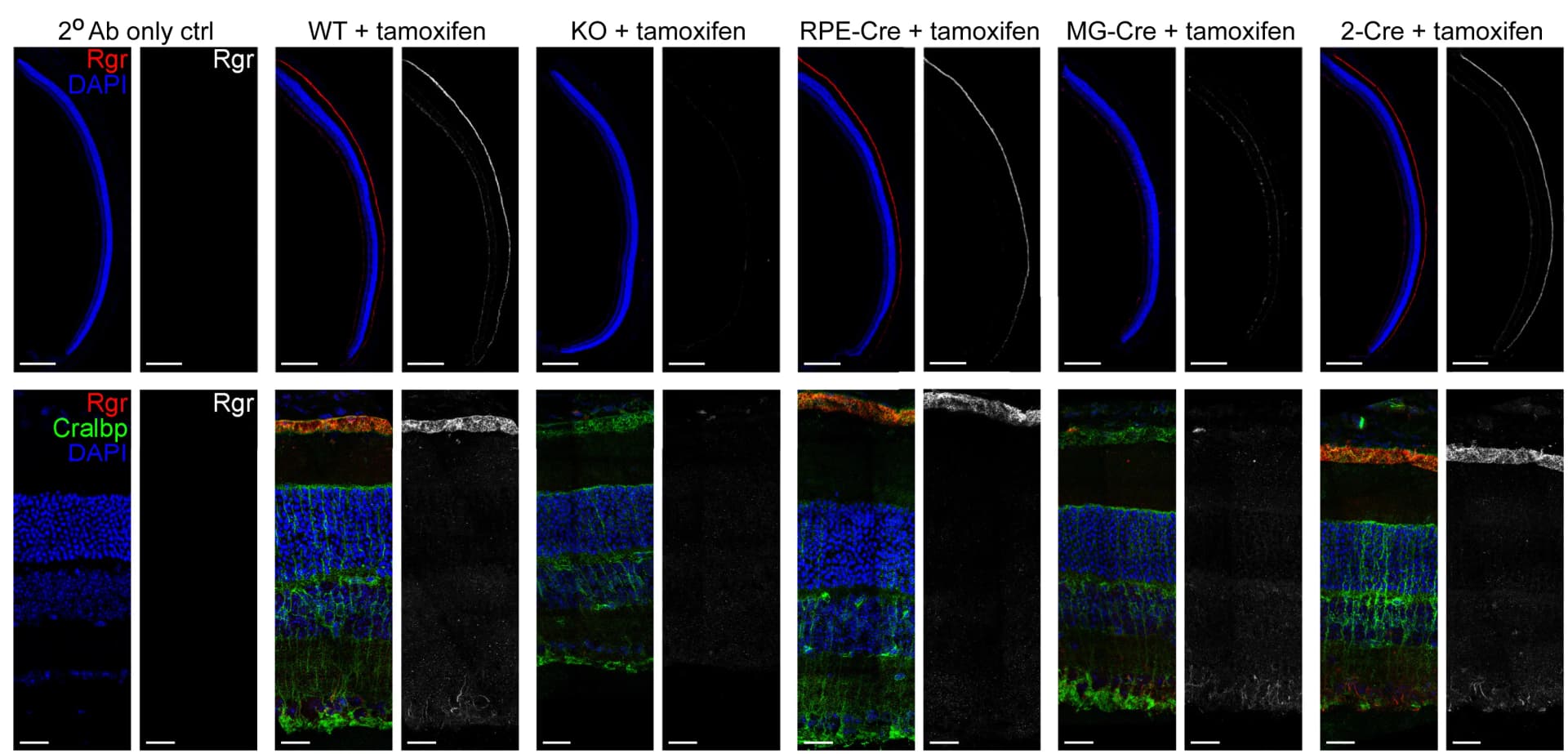 Open access visualization of Microscopy, IHC, Eye Cryosections, Wild Type, Knockout
