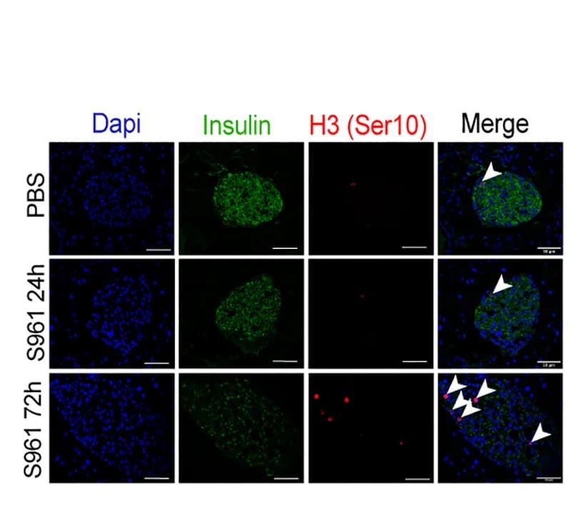 Open access visualization of Microscopy, Immunohistochemistry, Pancreatic Sections, Mice, PBS