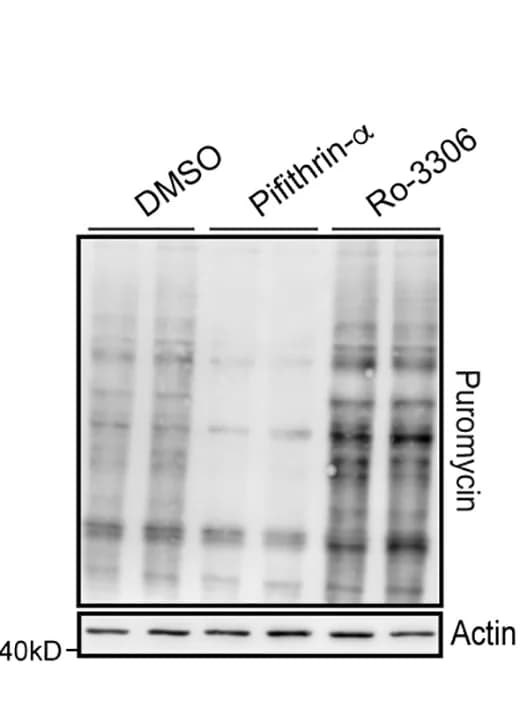 Open access visualization of Gel, Translation quantification, Puromycin labeling, Synchronized Min6 cells, DMSO