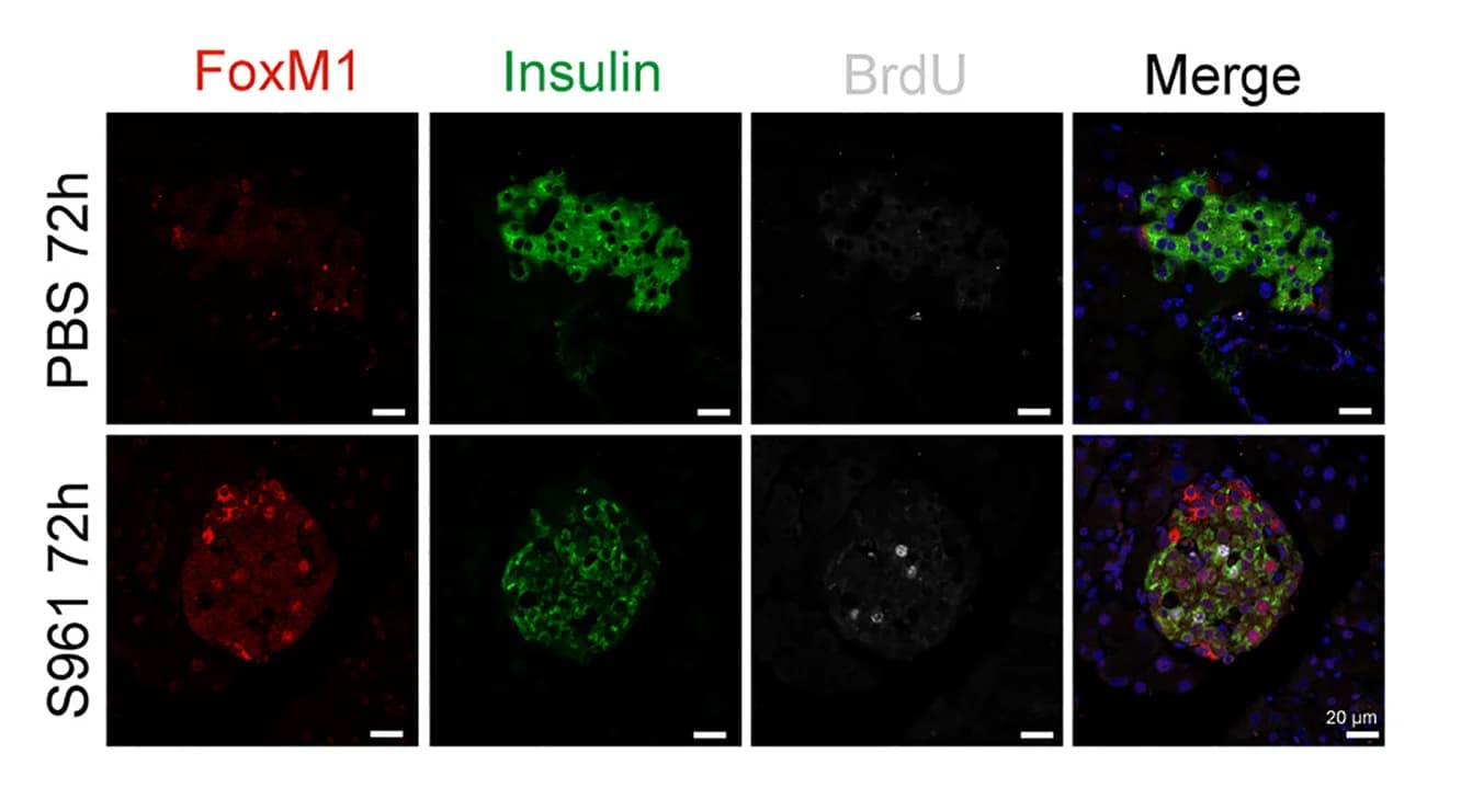 Open access visualization of Microscopy, Immunohistochemistry, Pancreatic Sections, Mice, PBS