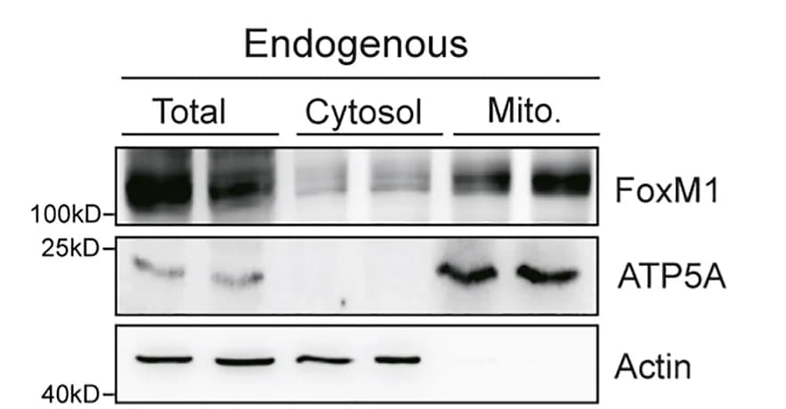 Open access visualization of Gel, Western Blot, Proteins, Mouse Islets, Ad:FoxM1
