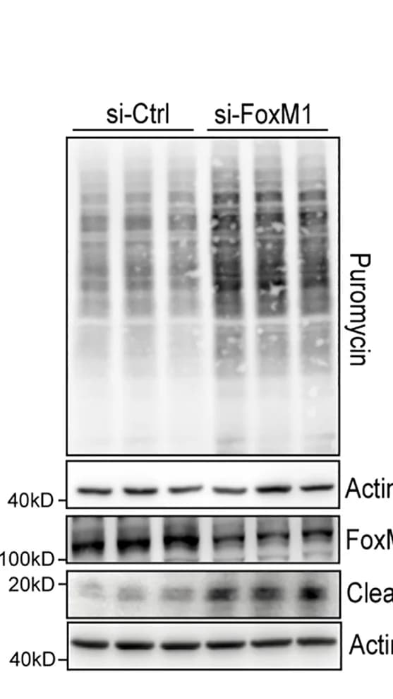 Open access visualization of Gel, Western Blot, Proteins, Min6 Cells, si-FoxM1
