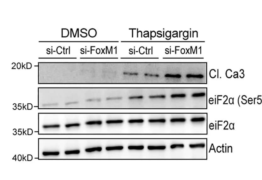 Open access visualization of Gel, Western Blot, Proteins, Min6 Cells, si-FoxM1