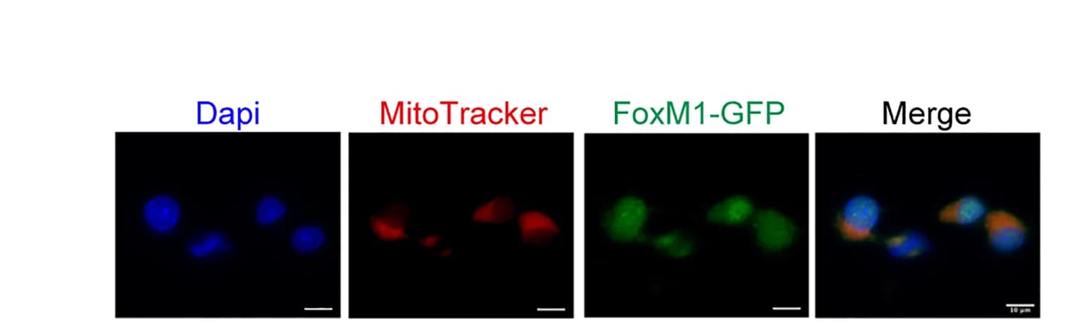 Open access visualization of Microscopy, Immunohistochemistry, Min6 Cells, GFP-Tagged FoxM1, MitoTracker