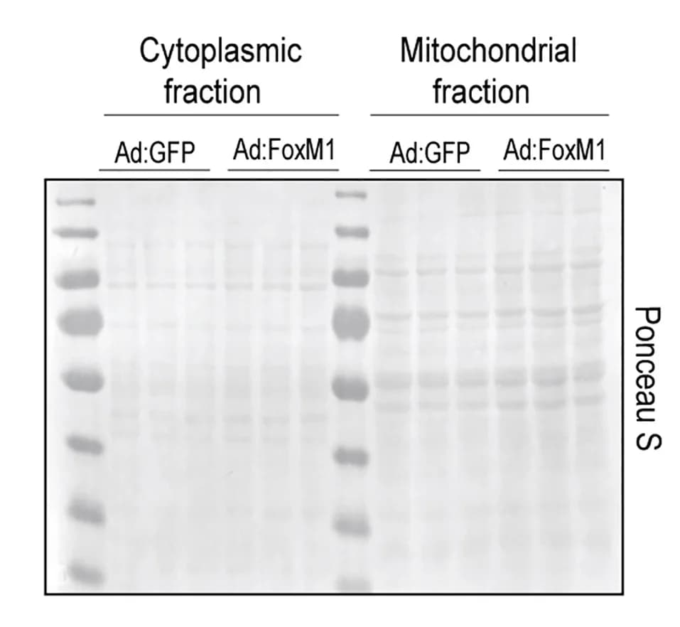 Open access visualization of Gel, Protein Synthesis, Puromycin Labeling, Cytosolic Fraction, Mitochondrial Fraction