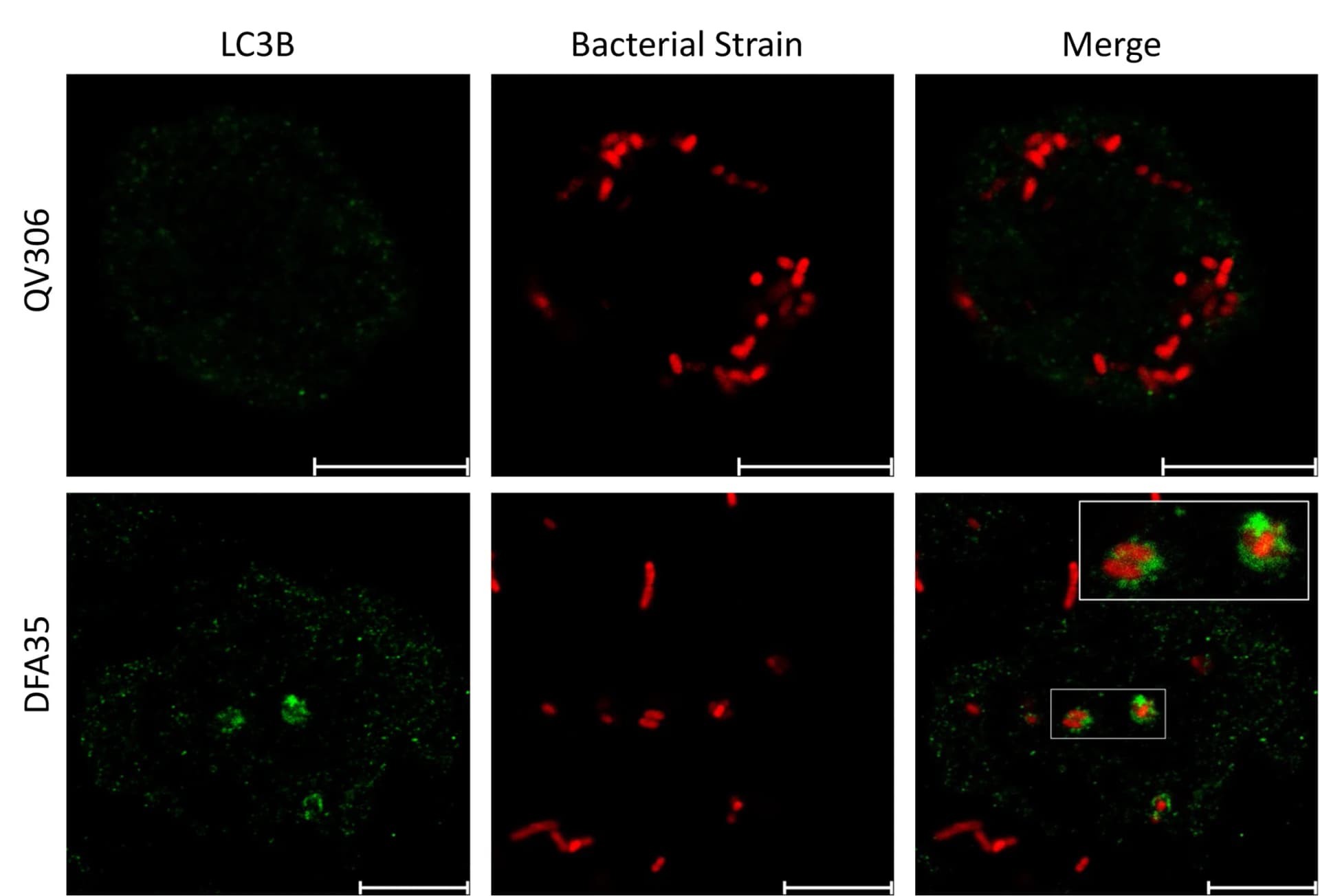 Open access visualization of Microscopy, THP-1 Macrophages, Immunofluorescence, LC3B, Autophagosome
