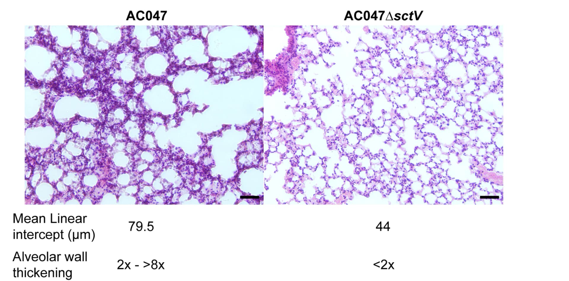Open access visualization of Microscopy, Mouse, AC047ΔsctV, AC047, Alveolar Destruction