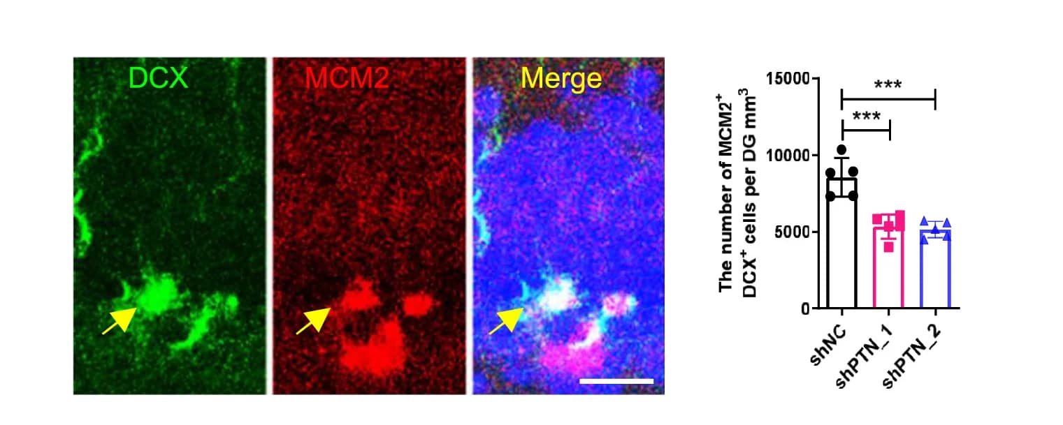 Open access visualization of Microscopy, Bar Plot, Error Bars, MCM2+DCX+ Proliferated Neuroblasts, DG