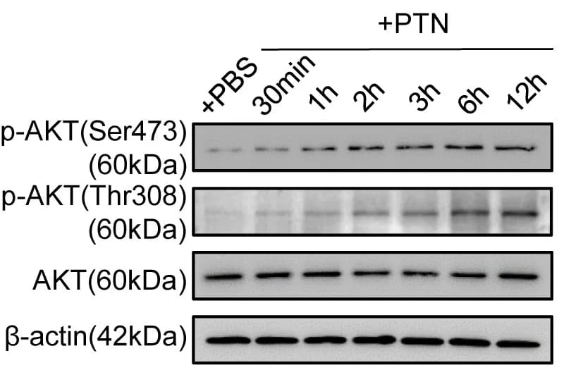 Open access visualization of Gel, AKT Activation, NSPC cultures, PTN