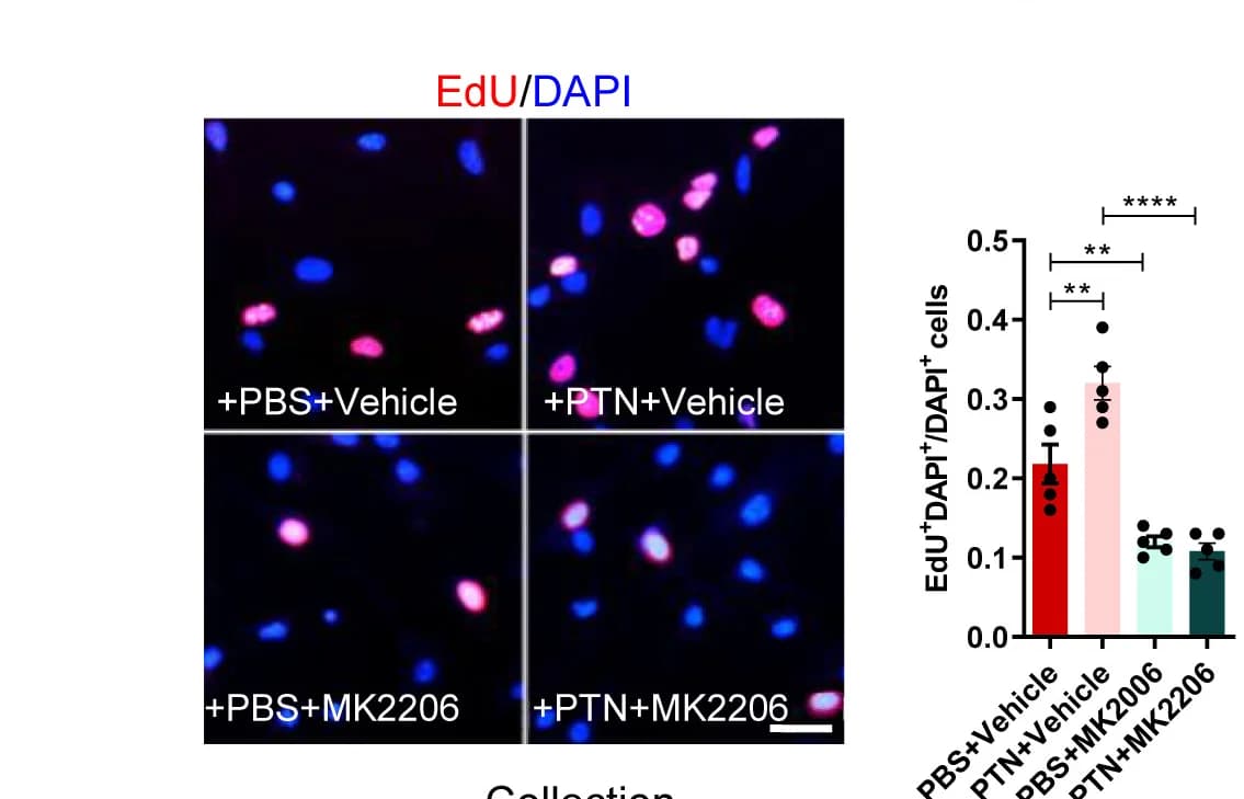 Open access visualization of Bar Plot, Error Bars, NSPC proliferation, DAPI, EdU
